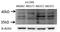 Cyclin Dependent Kinase 6 antibody, 14052-1-AP, Proteintech Group, Western Blot image 