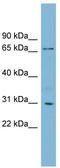 TBCC Domain Containing 1 antibody, TA344924, Origene, Western Blot image 