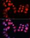 ATP Binding Cassette Subfamily B Member 7 antibody, LS-C749680, Lifespan Biosciences, Immunofluorescence image 