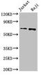 Cell Division Cycle 6 antibody, CSB-PA857873LA01HU, Cusabio, Western Blot image 