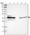 Aminoacyl TRNA Synthetase Complex Interacting Multifunctional Protein 2 antibody, PA5-53923, Invitrogen Antibodies, Western Blot image 