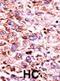 Checkpoint Kinase 1 antibody, abx031851, Abbexa, Immunohistochemistry frozen image 