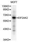 Eukaryotic Translation Initiation Factor 2 Alpha Kinase 2 antibody, abx004270, Abbexa, Western Blot image 