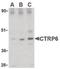 C1q And TNF Related 6 antibody, LS-B468, Lifespan Biosciences, Western Blot image 