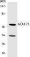 TADA2A antibody, LS-C200085, Lifespan Biosciences, Western Blot image 