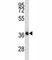 NK2 Homeobox 4 antibody, F43599-0.4ML, NSJ Bioreagents, Western Blot image 