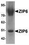 Solute Carrier Family 39 Member 6 antibody, A05693, Boster Biological Technology, Western Blot image 