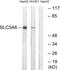 Solute Carrier Family 5 Member 6 antibody, GTX87516, GeneTex, Western Blot image 