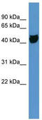 Olfactory Receptor Family 1 Subfamily S Member 1 (Gene/Pseudogene) antibody, TA342703, Origene, Western Blot image 