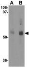 Major facilitator superfamily domain-containing protein 2A antibody, GTX85147, GeneTex, Western Blot image 