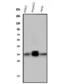 Palmitoyl-Protein Thioesterase 1 antibody, M02690, Boster Biological Technology, Western Blot image 