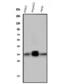 Palmitoyl-protein thioesterase 1 antibody, M02690, Boster Biological Technology, Western Blot image 