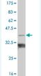 T-Box 18 antibody, H00009096-M01, Novus Biologicals, Western Blot image 