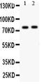 Lysosomal Associated Membrane Protein 1 antibody, PA1822, Boster Biological Technology, Western Blot image 