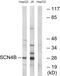 Sodium Voltage-Gated Channel Beta Subunit 4 antibody, GTX87443, GeneTex, Western Blot image 