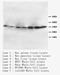 CD40 Ligand antibody, LS-B11325, Lifespan Biosciences, Western Blot image 