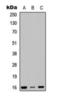 Ribosomal Protein S23 antibody, orb393152, Biorbyt, Western Blot image 