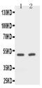 CD2 Molecule antibody, PA5-78965, Invitrogen Antibodies, Western Blot image 