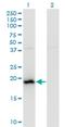 BAALC Binder Of MAP3K1 And KLF4 antibody, H00079870-M01, Novus Biologicals, Western Blot image 