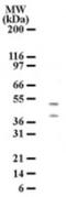 HtrA Serine Peptidase 2 antibody, NB100-56558, Novus Biologicals, Western Blot image 