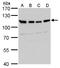 USO1 Vesicle Transport Factor antibody, GTX115115, GeneTex, Western Blot image 