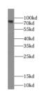 Lactoperoxidase antibody, FNab04834, FineTest, Western Blot image 