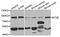 5'-Nucleotidase Ecto antibody, LS-B14527, Lifespan Biosciences, Western Blot image 