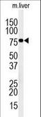 INO80 Complex Subunit D antibody, LS-C165234, Lifespan Biosciences, Western Blot image 