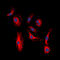 Erb-B2 Receptor Tyrosine Kinase 3 antibody, GTX32388, GeneTex, Immunofluorescence image 