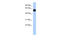 Membrane Palmitoylated Protein 7 antibody, 26-765, ProSci, Western Blot image 