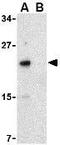 NFKB Inhibitor Interacting Ras Like 2 antibody, GTX31273, GeneTex, Western Blot image 