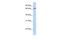 Ring Finger Protein 139 antibody, PA5-42295, Invitrogen Antibodies, Western Blot image 