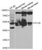 Propionyl-CoA Carboxylase Subunit Beta antibody, TA332679, Origene, Western Blot image 