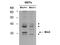 Bridging Integrator 3 antibody, M11817, Boster Biological Technology, Western Blot image 