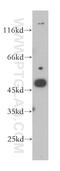 Melanoma-associated antigen 11 antibody, 15474-1-AP, Proteintech Group, Western Blot image 