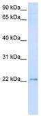 Transmembrane Protein 9 antibody, TA342012, Origene, Western Blot image 