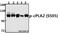 Phospholipase A2 Group IVA antibody, A00854S505, Boster Biological Technology, Western Blot image 