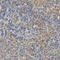 Protein Kinase C Epsilon antibody, LS-C331903, Lifespan Biosciences, Immunohistochemistry paraffin image 