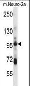 SMAD Specific E3 Ubiquitin Protein Ligase 1 antibody, LS-C161330, Lifespan Biosciences, Western Blot image 