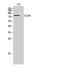 Glucosamine (UDP-N-Acetyl)-2-Epimerase/N-Acetylmannosamine Kinase antibody, GTX33966, GeneTex, Western Blot image 