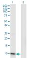 CDC28 Protein Kinase Regulatory Subunit 2 antibody, H00001164-M01, Novus Biologicals, Western Blot image 