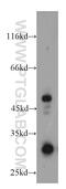 HUS1 Checkpoint Clamp Component B antibody, 18229-1-AP, Proteintech Group, Western Blot image 