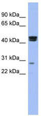 Heat Shock Transcription Factor Y-Linked 2 antibody, TA345471, Origene, Western Blot image 