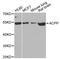 Acid Phosphatase, Prostate antibody, STJ22491, St John