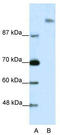SPT6 Homolog, Histone Chaperone And Transcription Elongation Factor antibody, TA343365, Origene, Western Blot image 