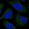 Centromere Protein M antibody, PA5-59969, Invitrogen Antibodies, Immunofluorescence image 