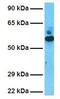 GDP Dissociation Inhibitor 2 antibody, GTX30782, GeneTex, Western Blot image 