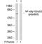 Nuclear Factor Kappa B Subunit 2 antibody, GTX79000, GeneTex, Western Blot image 