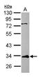 ETS Variant 7 antibody, PA5-30624, Invitrogen Antibodies, Western Blot image 