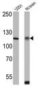 Calcium Sensing Receptor antibody, GTX79178, GeneTex, Western Blot image 